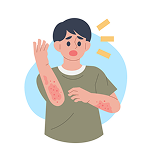 Skin rashes or itchy skin